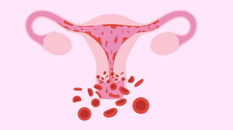 Heavy Periods