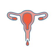 Leucorrhoea